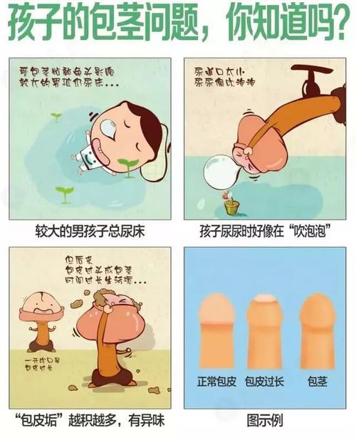 儿童-儿童包皮过长几岁做手术最好
