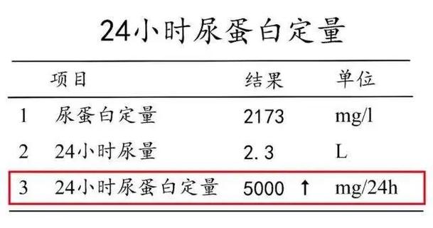 测试24-测试24小时尿液