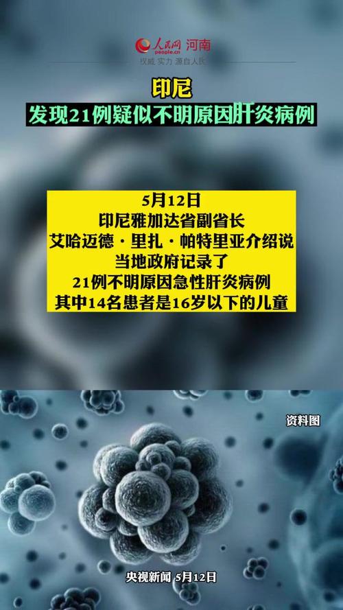 印尼发现21例疑似不明原因肝炎病例-印尼发现21例疑似不明原因肝炎病例