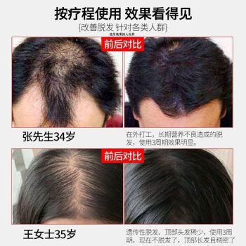 康迪-康迪生防脱固发洗发水有用吗